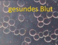 Bild 4 von BLUT